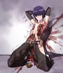 1551451